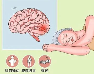 優(yōu)勢(shì)學(xué)科|17 年癲癇折磨終解脫！錦州市中心醫(yī)院癲癇門(mén)診規(guī)范治療為患者點(diǎn)亮希望之光